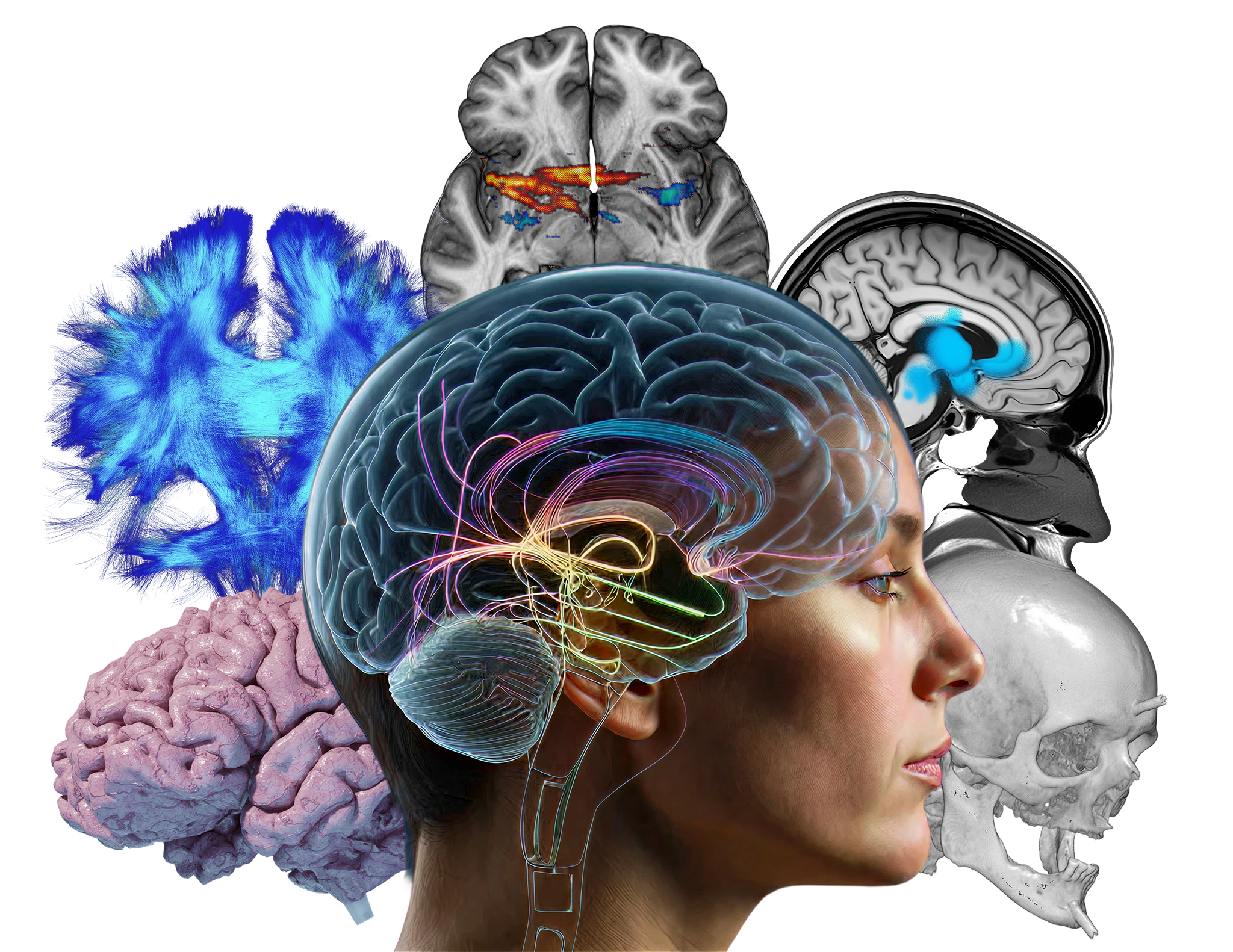 High-resolution MRI brain with tractography and connectivity overlays.